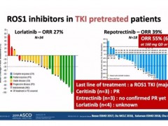 Repotrectinib(洛普替尼）