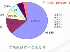 宫颈癌传播途径