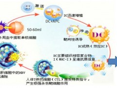 DC_CTL治疗技术