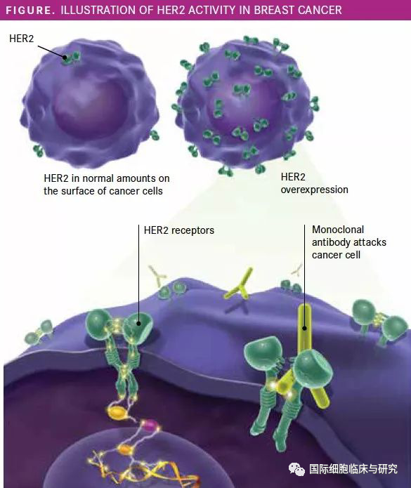 胃癌最具代表性的靶点HER2