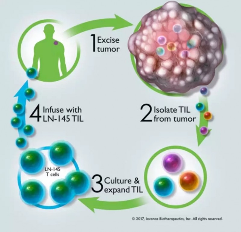 精准治疗的TIL疗法
