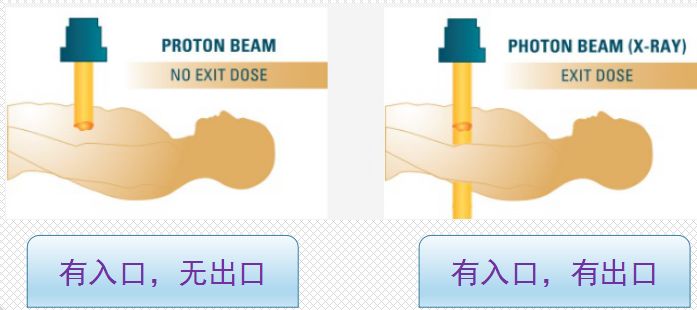 质子治疗放射剂量优势