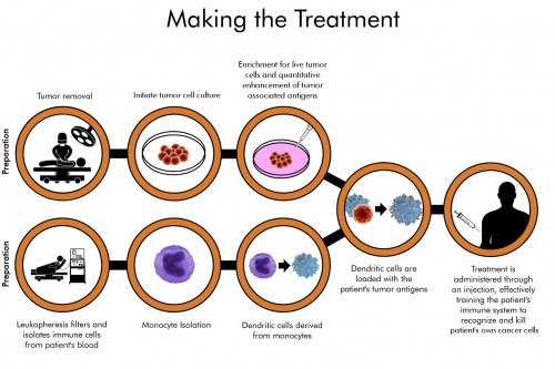 树突细胞疫苗AV-GBM-1治疗脑瘤的过程