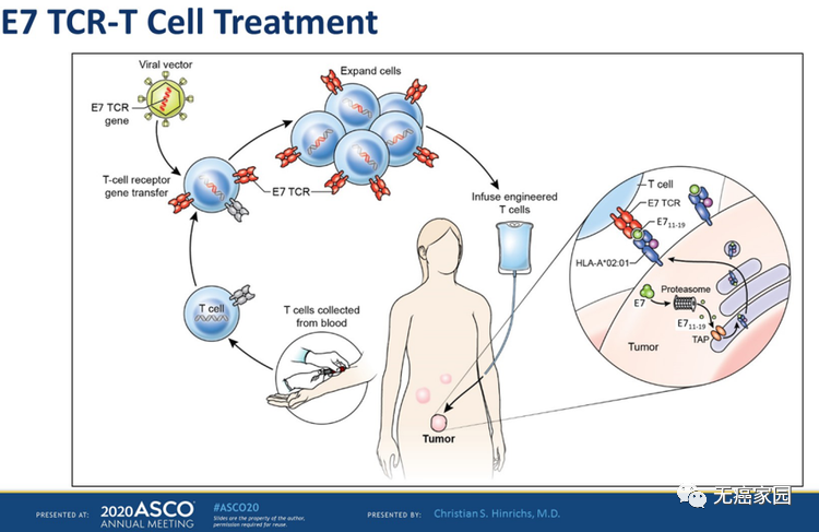 E7 TCR-T细胞治疗过程