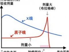 肺癌放疗,肺癌精准放疗,肺癌质子放疗,肺癌质子治疗