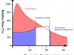 食管癌放疗,食管癌质子放疗,食道癌放疗,食道癌质子放疗,食道癌质子治疗