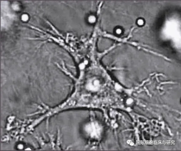 显微镜下，树突状细胞长满了“树枝样的突起”