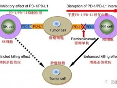 国内首创非小细胞肺癌免疫组合治疗,非小细胞肺癌免疫联合治疗,NK细胞助力PD-1抗癌效果倍增