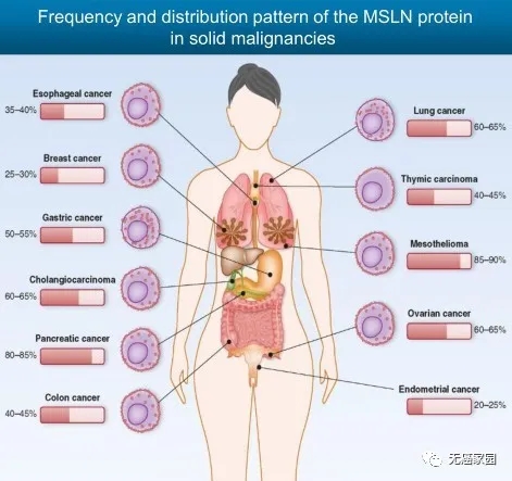 间皮素高表达的癌种