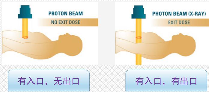 质子放疗和传统放疗对比