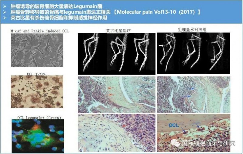 莱古比星对骨转移的作用