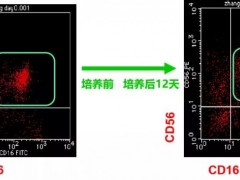 新型NK细胞免疫疗法,NK细胞疗法,NK细胞治疗治疗实体瘤潜力无穷