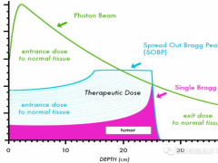 胸部放疗,胸部肿瘤放疗,胸部肿瘤质子放疗,胸部肿瘤质子治疗