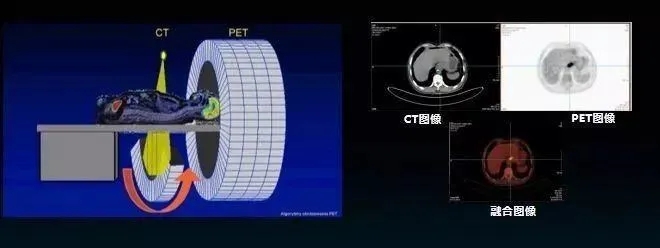 派特CT检查