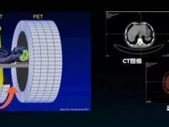 PETCT是什么检查,派特CT能检查什么,派特CT能查出哪些肿瘤