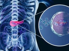 最新胰腺癌联合治疗,胰腺癌新药SM-88被FDA授予胰腺癌孤儿药地位