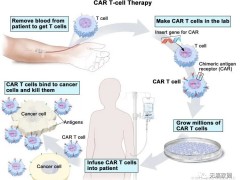 CAR-T细胞疗法,CAR-T细胞治疗,CAR-T细胞免疫疗法