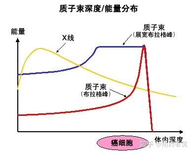 质子治疗和传统放疗对比