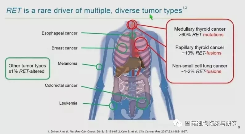RET融合突变的癌种