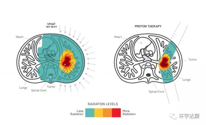 脑瘤质子治疗和传统放疗照射面积对比