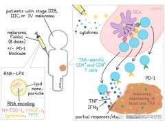 黑色素瘤疫苗,黑色素瘤RNA疫苗FixVac患者PD-1耐药后仍有效