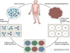 肉瘤肿瘤浸润淋巴细胞TIL疗法临床试验招募开启