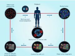 TIL疗法,未来肉瘤及更多肿瘤将因TIL疗法获益