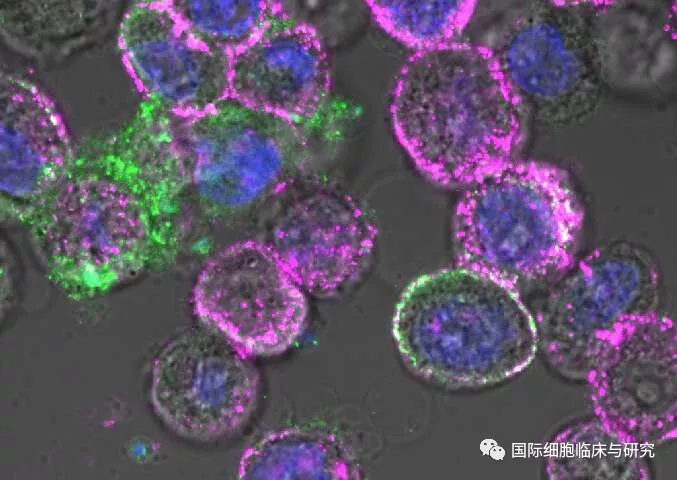 溶瘤病毒进入癌细胞后,迫使大量CD19在其细胞表面表达(以紫色显示)