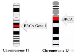 遗传性乳腺癌BRCA基因突变,BRCA突变靶向药,BRCA靶向药,PARP抑制剂有哪些