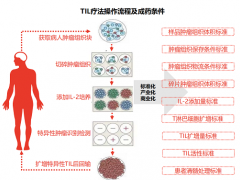 肿瘤浸润淋巴细胞,TIL细胞免疫疗法,TILs免疫疗法-LN145即将上市