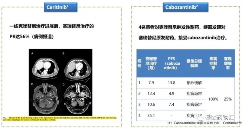 一线克唑替尼耐药后塞瑞替尼治疗效果