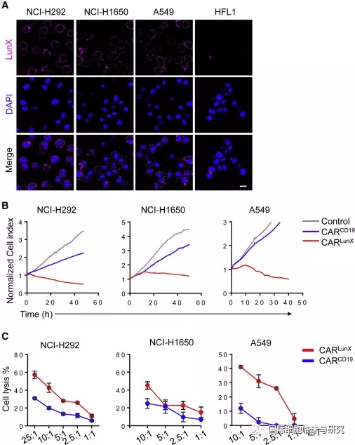 CAR-LunX-T治疗数据