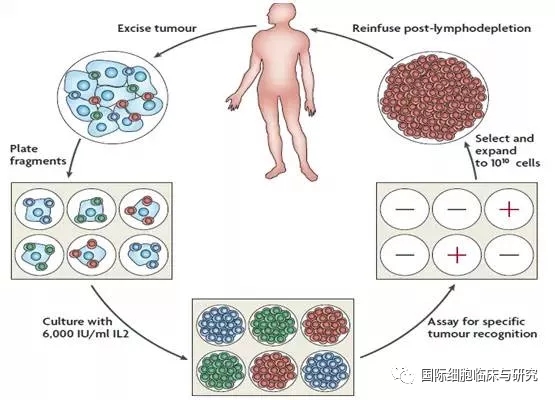 TIL细胞免疫疗法