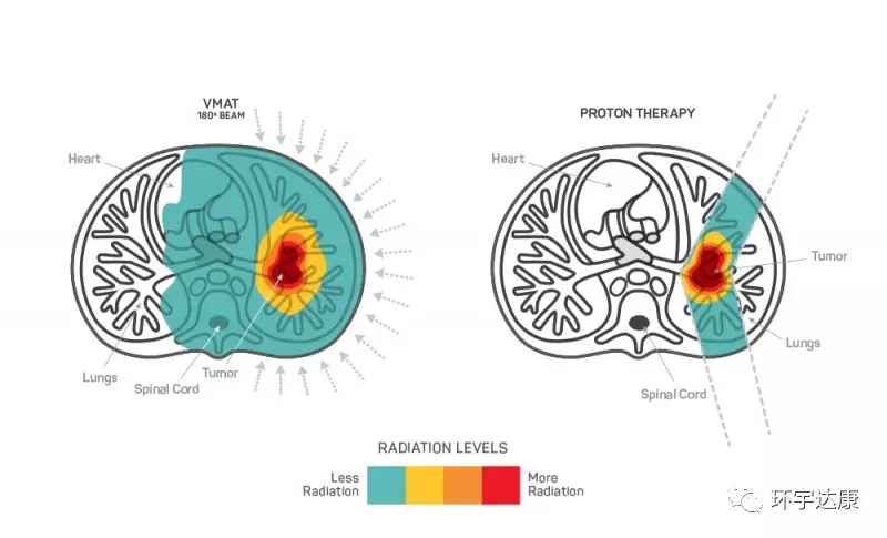 质子治疗和传统放疗照射面积对比