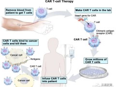 实体肿瘤血液肿瘤CART细胞疗法,CAR-T免疫疗法,CAR-T治疗技术井喷时代来临