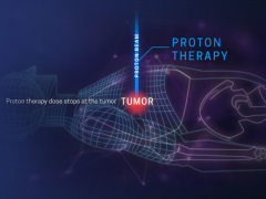 质子治疗肿瘤癌症精度更高副作用更小