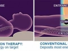 国癌症研究院实锤:与癌症肿瘤传统放疗相比质子治疗的优势是更安全、副作用更小