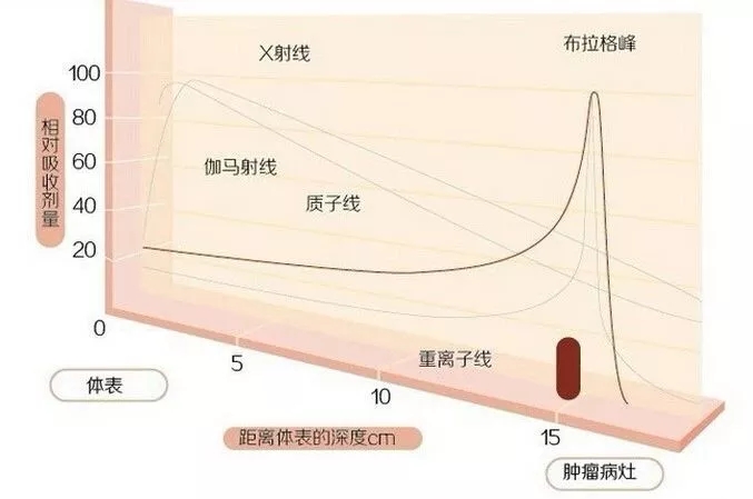 不同放射治疗射线对比