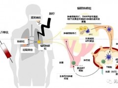 免疫联合治疗,免疫联合放疗,免疫联合疗法,免疫治疗联合放疗