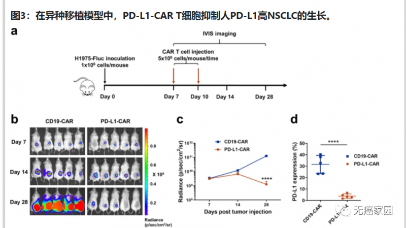 PD-L1-CAR-T治疗效果