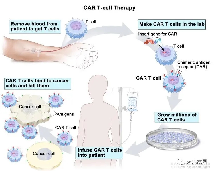 CAR-T细胞免疫疗法回输过程