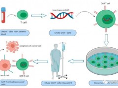 实体瘤CAR-T细胞免疫疗法升级,多种新型靶标CAR-T细胞免疫治疗结直肠癌,CAR-T细胞疗法临床试验