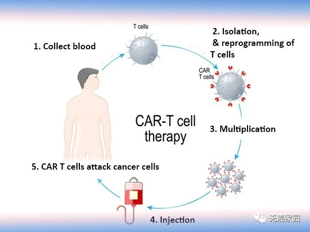 CART治疗血液肿瘤流程
