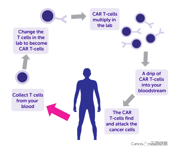 CAR-T细胞免疫疗法