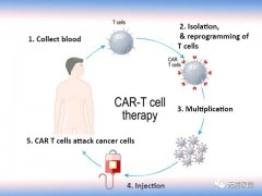 CART治疗淋巴瘤,淋巴瘤CAR-T临床试验招募进行中