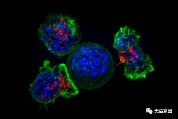 杀伤性T细胞包围癌细胞