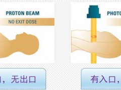 髓母细胞瘤放疗,质子治疗髓母细胞瘤让6岁男孩重回正常生活