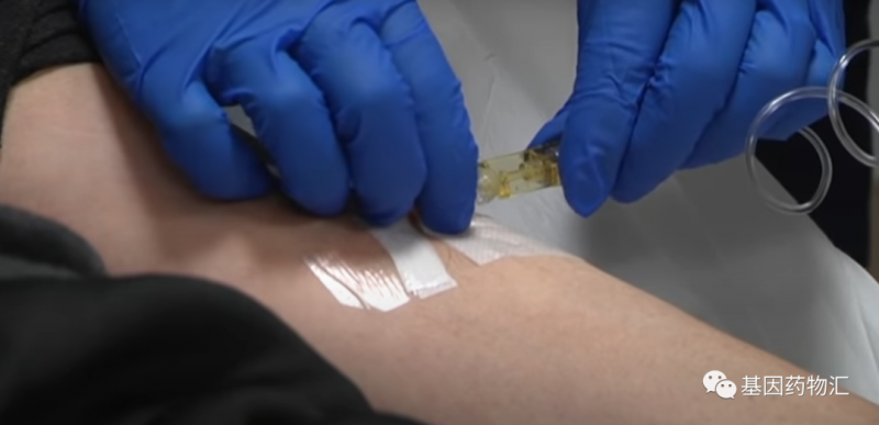 国家药监局最新发布！用病毒杀癌的“黑科技”，终于走入临床了！