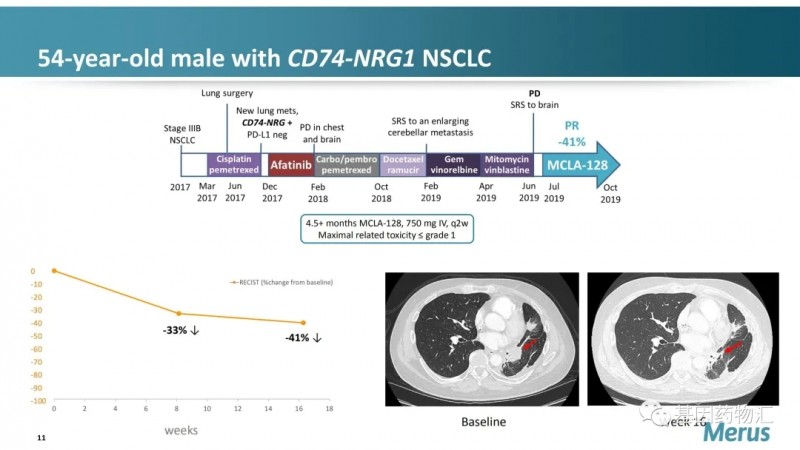 MCLA-128治疗肺癌效果