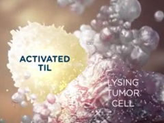 美国肿瘤浸润淋巴细胞TIL细胞治疗费用高?中国成功研发超级TIL,晚期癌症患者有救了